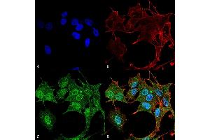 Immunocytochemistry/Immunofluorescence analysis using Rabbit Anti-ATG4B Polyclonal Antibody . (ATG4B 抗体  (AA 94-106) (FITC))