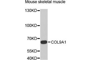 Western blot analysis of extracts of mouse skeletal muscle, using COL9A1 antibody (ABIN5975036) at 1/1000 dilution. (COL9A1 抗体)