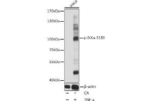 Western blot analysis of extracts of HeLa cells, using Phospho-IKKα-S180 antibody (ABIN6135203, ABIN6136048, ABIN6136049 and ABIN6225542) at 1:1000 dilution. (IKK alpha 抗体  (pSer180))