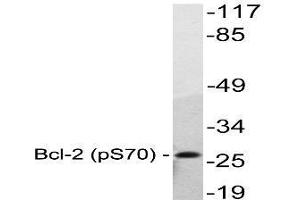 Image no. 1 for anti-B-Cell CLL/lymphoma 2 (BCL2) (pSer70) antibody (ABIN317971) (Bcl-2 抗体  (pSer70))