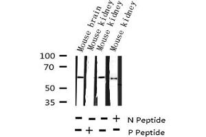 Western blot analysis of Phospho-Smad1 (Ser187) expression in various lysates (SMAD1 抗体  (pSer187))