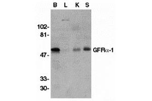 Western Blotting (WB) image for anti-GDNF Family Receptor alpha 1 (GFRA1) (Middle Region) antibody (ABIN1030937) (GFRA1 抗体  (Middle Region))