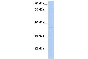 DRG1 antibody used at 1 ug/ml to detect target protein. (DRG1 抗体  (N-Term))