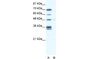 WB Suggested Anti-GLIS2 Antibody Titration: 2. (GLIS2 抗体  (N-Term))