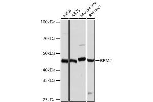 Western blot analysis of extracts of various cell lines, using RRM2 Rabbit mAb (ABIN7269989) at 1:1000 dilution. (RRM2 抗体)