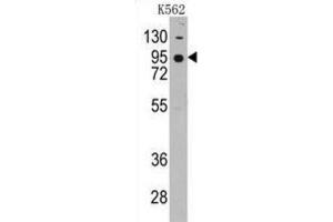 Western Blotting (WB) image for anti-Cadherin 7 (CDH7) antibody (ABIN2998181) (Cadherin 7 抗体)