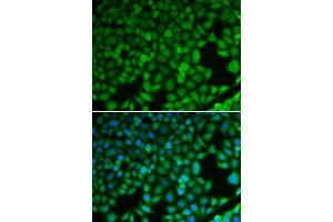 Immunofluorescence analysis of U2OS cells using NDRG1 antibody. (NDRG1 抗体  (AA 175-394))
