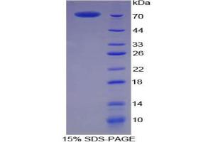 SDS-PAGE analysis of Pig CKM Protein. (CKM 蛋白)
