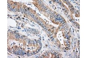 Immunohistochemical staining of paraffin-embedded Kidney tissue using anti-ARHGDIA mouse monoclonal antibody. (ARHGDIA 抗体)