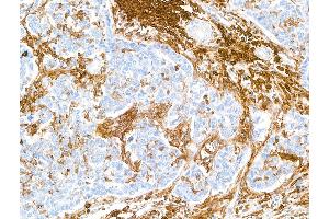 Immunohistochemistry (IHC) image for anti-CD38 (AA 43-300) antibody (ABIN7453961) (Recombinant CD38 抗体  (AA 43-300))