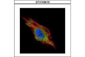 Image no. 2 for anti-Charged Multivesicular Body Protein 2B (CHMP2B) (AA 1-213) antibody (ABIN1497503) (CHMP2B 抗体  (AA 1-213))