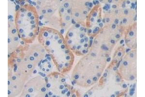 Detection of CD244 in Rat Kidney Tissue using Polyclonal Antibody to Cluster of Differentiation 244 (CD244) (2B4 抗体  (AA 20-221))
