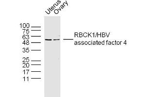 Western Blotting (WB) image for anti-RanBP-Type and C3HC4-Type Zinc Finger Containing 1 (RBCK1) (AA 251-350) antibody (ABIN4913528)