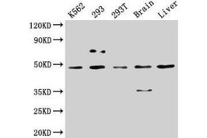 Western Blot Positive WB detected in: K562 whole cell lysate, 293 whole cell lysate, 293T whole cell lysate, Rat brain tissue, Mouse liver tissue All lanes: CSNK1D antibody at 5 μg/mL Secondary Goat polyclonal to rabbit IgG at 1/50000 dilution Predicted band size: 48, 47 kDa Observed band size: 48 kDa (Casein Kinase 1 delta 抗体  (Isoform delta))
