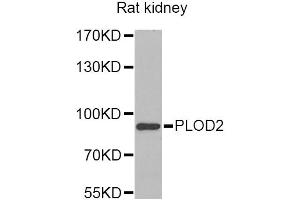 Western blot analysis of extracts of rat kidney, using PLOD2 Antibody (ABIN2564587) at 1:1000 dilution. (PLOD2 抗体)