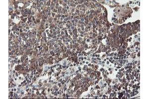 Image no. 9 for anti-Diphthamide Biosynthesis Protein 2 (DPH2) antibody (ABIN1497893)