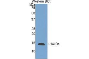 Western blot analysis of the recombinant protein. (INHBE 抗体  (AA 237-350))