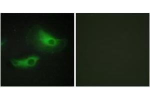 Immunofluorescence (IF) image for anti-Adducin 2 (Beta) (ADD2) (AA 471-520) antibody (ABIN2889855) (ADD2 抗体  (AA 471-520))