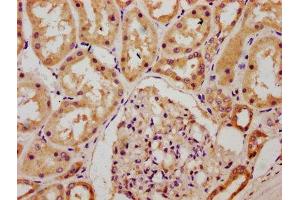IHC image of ABIN7147645 diluted at 1:300 and staining in paraffin-embedded human kidney tissue performed on a Leica BondTM system. (CHSY1 抗体  (AA 32-148))