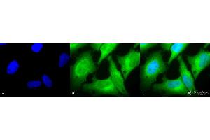 Immunocytochemistry/Immunofluorescence analysis using Rabbit Anti-HO-1 Polyclonal Antibody . (HMOX1 抗体  (HRP))