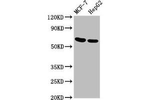 Western Blot Positive WB detected in: MCF-7 whole cell lysate, HepG2 whole cell lysate All lanes: GNAS antibody at 3. (GNAS 抗体  (AA 310-404))