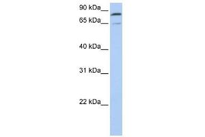 Mitofusin 2 antibody used at 1 ug/ml to detect target protein. (MFN2 抗体  (C-Term))