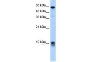 Image no. 2 for anti-S100 Calcium Binding Protein A3 (S100A3) (N-Term) antibody (ABIN204985) (S100A3 抗体  (N-Term))