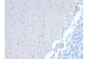 Formalin-fixed, paraffin-embedded human Brain stained with ATG5 Mouse Monoclonal Antibody (ATG5/2101). (ATG5 抗体  (AA 1-119))