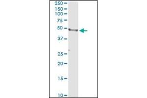 Western Blotting (WB) image for anti-CD177 Molecule (CD177) antibody (ABIN781918) (CD177 抗体)