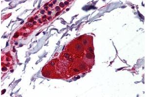 Human Small Intestine, Submucosal Plexus: Formalin-Fixed, Paraffin-Embedded (FFPE) (NDRG1 抗体  (AA 1-395))