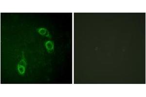 Immunofluorescence analysis of HepG2 cells, using APC1 (Ab-688) Antibody. (APC1 抗体  (AA 654-703))
