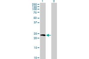 Western Blot analysis of HPCA expression in transfected 293T cell line by HPCA MaxPab polyclonal antibody. (Hippocalcin 抗体  (AA 1-193))