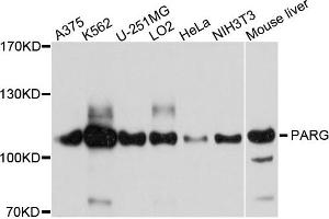 Western blot analysis of extracts of various cells, using PARG antibody. (PARG 抗体)