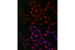 Immunofluorescence analysis of U2OS cells using VAPB Rabbit pAb (ABIN6132783, ABIN6150058, ABIN6150059 and ABIN6221003) at dilution of 1:100 (40x lens). (VAPB 抗体  (AA 10-222))