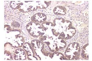 IHC analysis of WWOX using anti-WWOX antibody (ABIN6719627). (WWOX 抗体  (AA 1-245))