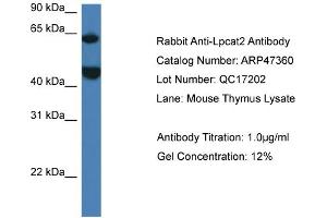 Western Blotting (WB) image for anti-Lysophosphatidylcholine Acyltransferase 2 (LPCAT2) (N-Term) antibody (ABIN2782922) (LPCAT2 抗体  (N-Term))