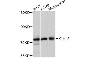 Western blot analysis of extracts of various cell lines, using KLHL3 antibody (ABIN6293045) at 1:3000 dilution. (KLHL3 抗体)