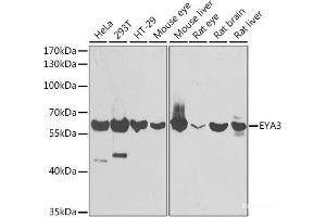 Western blot analysis of extracts of various cell lines using EYA3 Polyclonal Antibody at dilution of 1:1000. (EYA3 抗体)