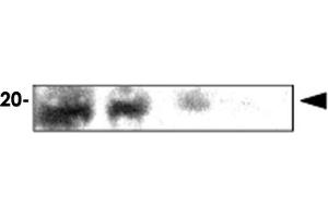 Immunoblot analysis of rat eye extracts were resolved by electrophoresis , transferred to PVDF membrane and probed with CRYAA monoclonal antibody , clone c9F2 (1 : 1000)  . (CRYAA 抗体  (AA 1-173))