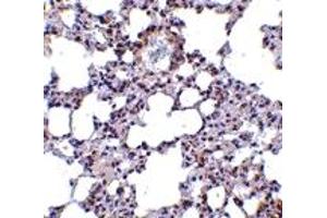 Immunohistochemistry (IHC) image for anti-Transient Receptor Potential Cation Channel, Subfamily C, Member 6 (TRPC6) (N-Term) antibody (ABIN1031645) (TRPC6 抗体  (N-Term))