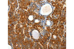 Immunohistochemistry (IHC) image for anti-Secretin Receptor (SCTR) antibody (ABIN1874706) (SCTR 抗体)