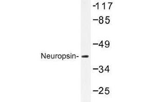 Image no. 1 for anti-serpin Peptidase Inhibitor, Clade I (neuroserpin), Member 1 (SERPINI1) antibody (ABIN317764)