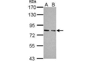 WB Image Sample (30 ug of whole cell lysate) A: JC B: BCL-1 7. (PRKG1 抗体  (Center))