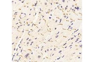 Immunohistochemistry analysis of paraffin-embedded mouse heart using,DSP (ABIN7073719) at dilution of 1: 1000 (Desmoplakin 抗体)