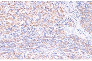Immunohistochemistry of paraffin-embedded Rat ovary using COX5A Polyclonal Antibody at dilution of 1:100 (40x lens). (COX5A 抗体)
