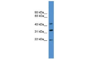WB Suggested Anti-ARFIP1 Antibody Titration: 0. (ARFIP1 抗体  (C-Term))