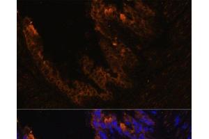 Immunofluorescence analysis of Mouse bronchus cells using KRT7 Polyclonal Antibody at dilution of 1:100. (Cytokeratin 7 抗体)