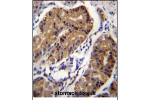 Immunohistochemistry (Paraffin-embedded Sections) (IHC (p)) image for anti-Deleted in Colorectal Carcinoma (DCC) (AA 643-670) antibody (ABIN656268)