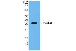 Detection of Recombinant PGLYRP1, Human using Polyclonal Antibody to Peptidoglycan Recognition Protein 1 (PGLYRP1) (PGLYRP1 抗体  (AA 22-196))