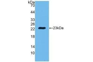 Detection of Recombinant PGLYRP1, Human using Polyclonal Antibody to Peptidoglycan Recognition Protein 1 (PGLYRP1) (PGLYRP1 抗体  (AA 22-196))